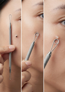 Stainless Steel Pimple Remover Tool Blackhead Extractor Needle Popper Tool - Product Image 3