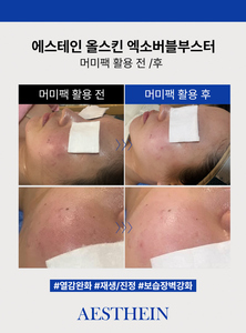 เอสเธน 200 มล. โทนเนอร์บับเบิ้ลบูสเตอร์สูตรพรีเมียม เซนเทลล่า เอเชียติก้า สำหรับผิวหน้าทุกประเภท ผลิตภัณฑ์บำรุงผิวจากเกาหลี - Product Image 6