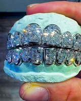 Grillz de Moissanita de Calidad Premium, Hechos a Medida, con Brillo Intenso y Diseño Seguro, Disponibles al Mejor Precio del Mercado