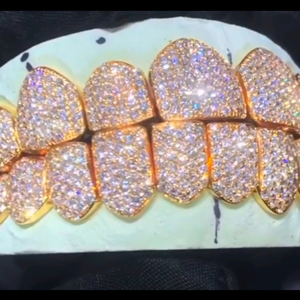 Meilleur prix pour Grillz dentaire personnalisé en argent 925, style Hip Hop, serti de diamants Moissanite, bijoux dentaires en argent - Product Image 2