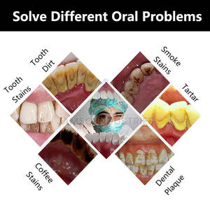 Complete Oral Care Tool <b>Kit</b> With <b>Plaque</b> <b>Remover</b> Tools And Storage Case For Dental Maintenance - Product Image 6