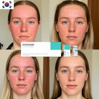 Sérum PDRN EXO aux cellules souches végétales coréennes pour la régénération cutanée, anti-inflammatoire, éclaircissant, réparateur, vitalisant et raffermissant