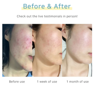 Limpiador Glicólico Exfoliante DM CELL AHA 180ml Hecho en Corea, Cosmético Coreano Nutritivo e Hidratante - Product Image 1