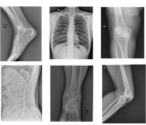 Tıbbi x-ray makinesi/20KW 32KW 50KW dijital DR radyografi sistemi düz Panel dedektör X Ray - Product Image 6