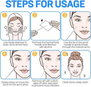 Herramienta de Limpieza de Poros Faciales, Extractor de Puntos Negros de Acero Inoxidable, Removedor de Puntos Blancos, Aguja para Acné, Herramienta de Belleza Profesional - Product Image 2