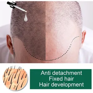 5 hari jahe penumbuh rambut produk alami anti rambut rontok mencegah kebotakan perawatan rambut tumbuh cepat esensi