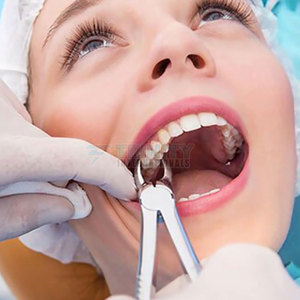 Forceps d'extraction dentaire de dernière conception 2026 en acier inoxydable de haute qualité - Product Image 3