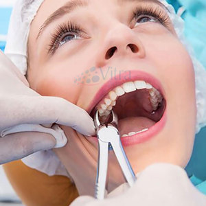 Forceps d'extraction dentaire manuels en acier inoxydable de haute qualité, certifiés CE, avec poignée ergonomique, réutilisables et légers - Product Image 3