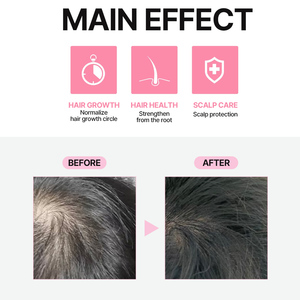Suero para el cuidado de la raíz del cabello con biotina OEM, equilibrio de hidratación, cosmético diario para el cuero cabelludo, uso doméstico - Product Image 2