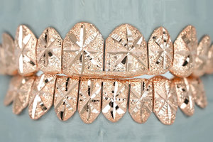 ตะแกรงสำหรับฟันฮิปฮอปที่กำหนดเองเย็นออก VVS Moissanite ย่าง925เงินสีเหลืองทองสตาร์เบิร์สตัดเพชร - Product Image 3