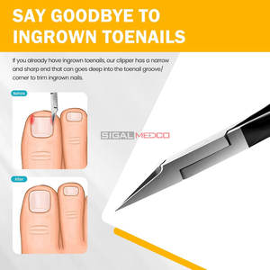 กรรไกรตัดเล็บเท้าใบมีดตรง ปลายแหลมเปิดกว้าง สำหรับผู้สูงอายุ เล็บเท้าหนา ตัดแต่งเล็บขบ สีดำ - Product Image 4