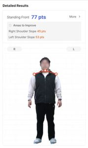 เครื่องวิเคราะห์สุขภาพอัจฉริยะ Bodydot BDF1000 ที่ใช้พลังงานจาก AI โครงอะลูมิเนียมอัลลอยด์ที่ยืดหยุ่นได้ ไม่สามารถพับเก็บได้ ติดตามสุขภาพทั่วร่างกาย - Product Image 6