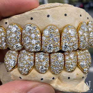 Grillz personnalisés plaqués or 14K avec moissanite, ensemble complet, taille brillant, sertissage griffe, certifiés par un tiers, bijoux dentaires unisexes style Hip Hop - Product Image 4