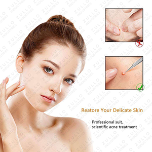 ชุดเครื่องมือดูแลผิวหน้าระดับพรีเมียม 15 ชิ้น ทำจากสแตนเลสสตีล สำหรับกำจัดสิวเสี้ยนและสิวอักเสบ ชุดอุปกรณ์ดูแลผิวหน้าระดับมืออาชีพ - Product Image 5