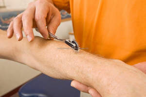 Outil de diagnostic chirurgical en acier inoxydable à prix de gros : Roue de Wartenberg neurologique pour sensation forte - Product Image 5