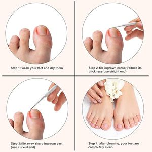 Lime à ongles professionnelle double face en acier inoxydable pour ongles incarnés, mini lime à ongles à motif diamant pour le soin des ongles, nouveau design - Product Image 3