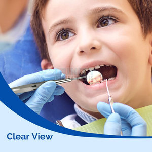 Dentist <b>Tools</b> <b>Teeth</b> <b>Clean</b> Dental Instruments Mouth Mirror Stainless Steel Mouth Mirror For Sale - Product Image 3