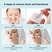 Extracteur de points noirs professionnel de haute qualité en acier inoxydable, emballage personnalisable, dernier design, beauté