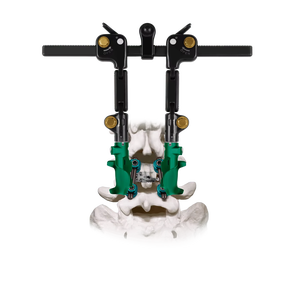 Sistema Lumbar Posterior Premium Phantom HANG 10 de Acero Inoxidable Reutilizable y Autoclavable, Juego de Retractores Quirúrgicos Lumbares Azicon - Product Image 3