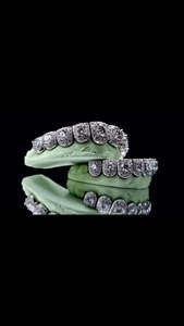 Grillz Moissanite en grappe de fleurs, sertis de grandes pierres, style Hip Hop, en argent sterling 925, ensemble de style soirée - Product Image 3