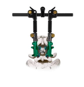 Juego de Instrumentos Quirúrgicos Ortopédicos de Acero Inoxidable Phantom CS para Cervicales Anteriores, Retractor Manual de Alta Calidad, Certificado CE, Industria Salaar - Product Image 6