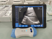Profesional New Pocket Palm 80 Elements Wireless USG Convex/Linear Phased Probe untuk Iphone dan Ipad