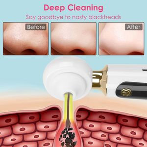 Electric Facial Pore Cleaner & <b>Blackhead</b> <b>Extractor</b> Tool <b>Blackhead</b> Vacuum Remover for Acne & Comedone Removal Pimple Suction Tool - Product Image 2
