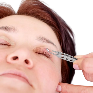 Pince expressoire à rouleaux efficace pour les glandes de Meibom, instrument chirurgical pour l'élimination des kératites séborrhéiques, conforme ISO - Product Image 5