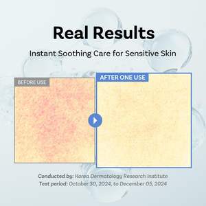 [APOTHE] Crema Hidratante Exo Some Squal Tox 60ml, Hidratación Duradera, Reafirmante, con Centella Asiática, Barrera Cutánea para Mujeres - Product Image 3