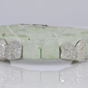 Grillz dentaire Hip Hop personnalisé en argent 925, serti de diamants Moissanite, bijoux dentaires en argent, meilleur prix - Product Image 4