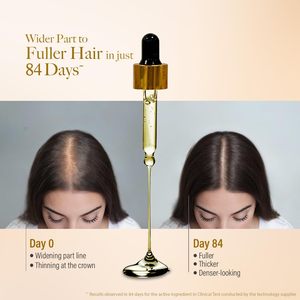 Suero para el Crecimiento del Cabello, Suero Nutritivo para Cabello Fino, Prueba Clínica de 84 Días - Product Image 1