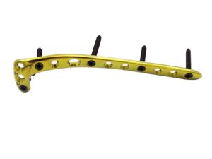 Plaques de blocage tibiales proximales professionnelles en acier inoxydable pour la vente en gros, instrument chirurgical manuel certifié CE ISO13485 OEM - Product Image 5