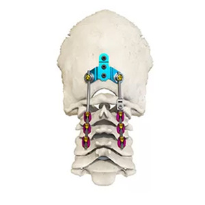 Ensemble chirurgical de composants d'implantation vertébrale en alliage de titane : Vis pédiculaires, tiges, crochets, connecteurs, équipement de fixation - Product Image 2