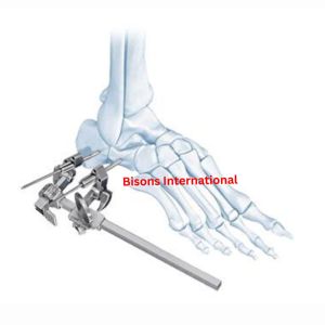 Instrumentos Quirúrgicos Ortopédicos para Pie y Tobillo BISONS, Kit de Instrumentos Quirúrgicos de Reconstrucción para Uso Ortopédico - Product Image 3