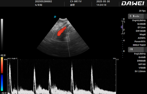 Éxito de Ventas: Escáner de Ultrasonido Veterinario Dawei, Máquina de Ultrasonido Portátil para Clínica Veterinaria - Product Image 3