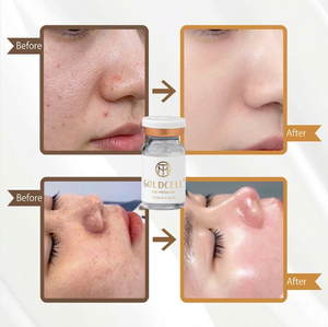 <b>Face</b> Skin Booster Goldcell Salmon DNA Solution for Brightening Whitening and Intense Moist - Product Image 1