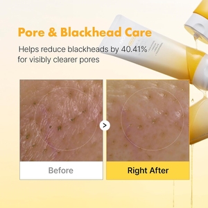 [APOTHE] Baku-Kaol Exfoliante Limpiador Iluminador 100ml Espuma Perlita Caolín Bakuchiol Exfoliación Suave Hidratante Limpieza de Poros - Product Image 3