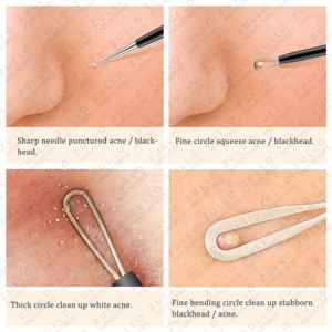 Kit de 5 Piezas de Extractores de Puntos Negros y Acné de Acero Inoxidable Premium, Herramientas Profesionales para Limpieza de Poros con Marca Personalizada - Product Image 6