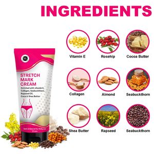 Crema de Masaje Anti-Estrías de Marca Privada para Uso Corporal Durante el Embarazo, Reduce las Estrías, Mantiene la Elasticidad, OEM/ODM - Product Image 3