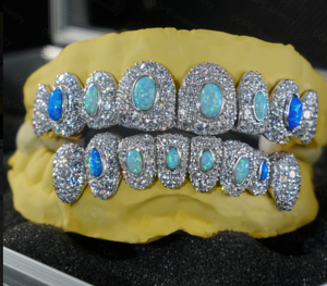 Grillz Hip Hop avec Pierres d'Opale et Accents de Diamants, Plaqué Or 18K, Bijoux de Fête Unisexe - Product Image 1