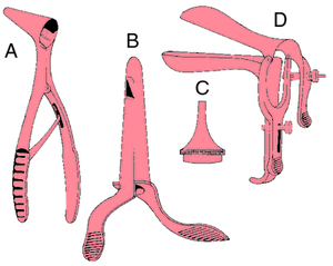 Spéculum vaginal électrochirurgical manuel professionnel en acier inoxydable avec architecture d'électrode pour une précision tissulaire - Product Image 5