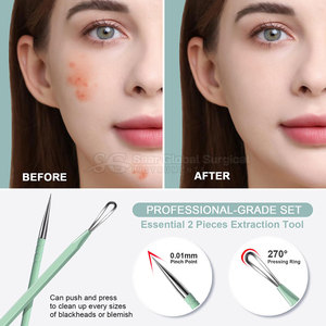 Extractor de Comedones Profesional Premium de Acero Inoxidable, Diseño Ergonómico con Agarre Cómodo y Acabado de Calidad para Uso Facial - Product Image 4