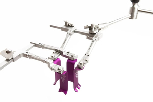 Système lombaire postérieur Premium Phantom HANG 10 en acier inoxydable, réutilisable et autoclavable, ensemble de rétracteurs chirurgicaux lombaires - Product Image 6