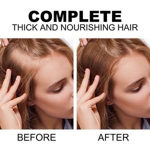 Tratamiento <span class=keywords><strong>de</strong></span> crecimiento rápido para el cabello, cuidado <span class=keywords><strong>de</strong></span> <span class=keywords><strong>la</strong></span> pérdida <span class=keywords><strong>de</strong></span> cabello, biotina, agua <span class=keywords><strong>de</strong></span> arroz negro, suero en aerosol para el crecimiento del cabello para hombres y mujeres - Product Image 6