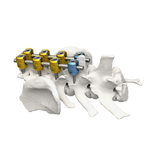 Vis de réduction polyaxiale et monoaxiale en alliage de titane pour chirurgie lombaire, prix usine - Product Image 1