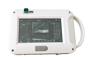 Cầm tay Xray máy với phẳng Detector được xây dựng trong máy tính x Ray máy kỹ thuật số chụp x quang hệ thống cho bệnh viện - Product Image 3