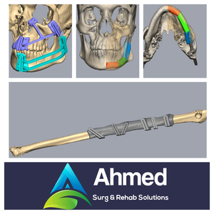 คู่มือการผ่าตัดคุณภาพสูงและแบบจำลองกายวิภาค 3 มิติจากอินเดีย - Product Image 4