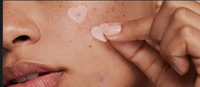 Parches Reusoul de Colágeno Hidrocoloide para Imperfecciones, AC Cica Spot Cover, Sin Fragancia, Forma de Corazón, 41 Parches, Veganos, Para Todo Tipo de Piel