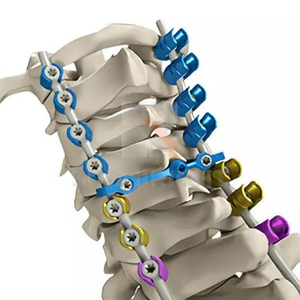 Ensemble d'instruments chirurgicaux pour implants orthopédiques et traumatologiques, vis canulée de 6,5 mm, outil de fixation vertébrale, certifié CE, vente en gros - Product Image 5