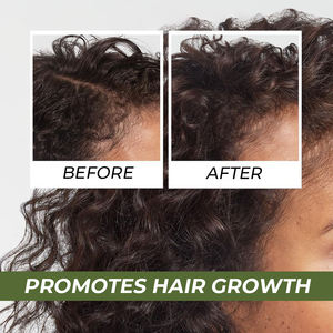 Regrowth Anti Hair Loss Treatment Hair Growth Customisable Advanced Natural Organic Hair Growth Serum - Product Image 6